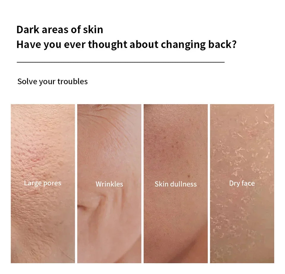 Close-up skin images showing large pores, wrinkles, dullness, and dry face issues with text about dark skin areas